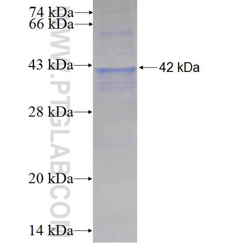 TSPAN3 fusion protein Ag0391 SDS-PAGE