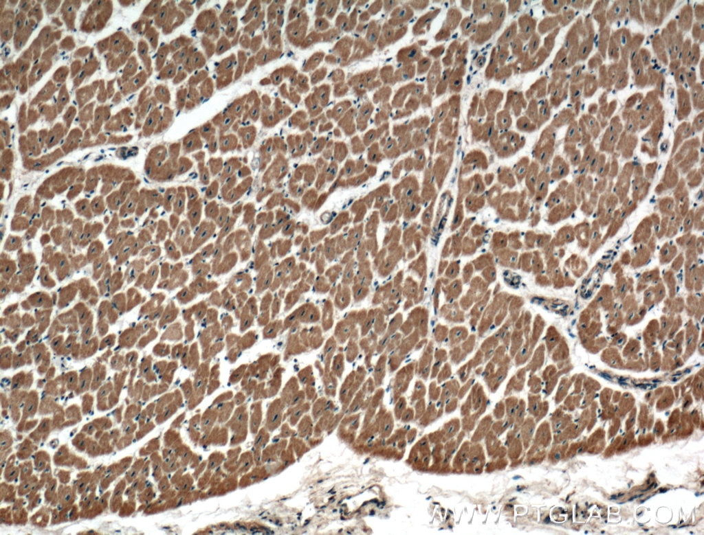Immunohistochemistry (IHC) staining of human heart tissue using TSPAN31 Polyclonal antibody (21987-1-AP)