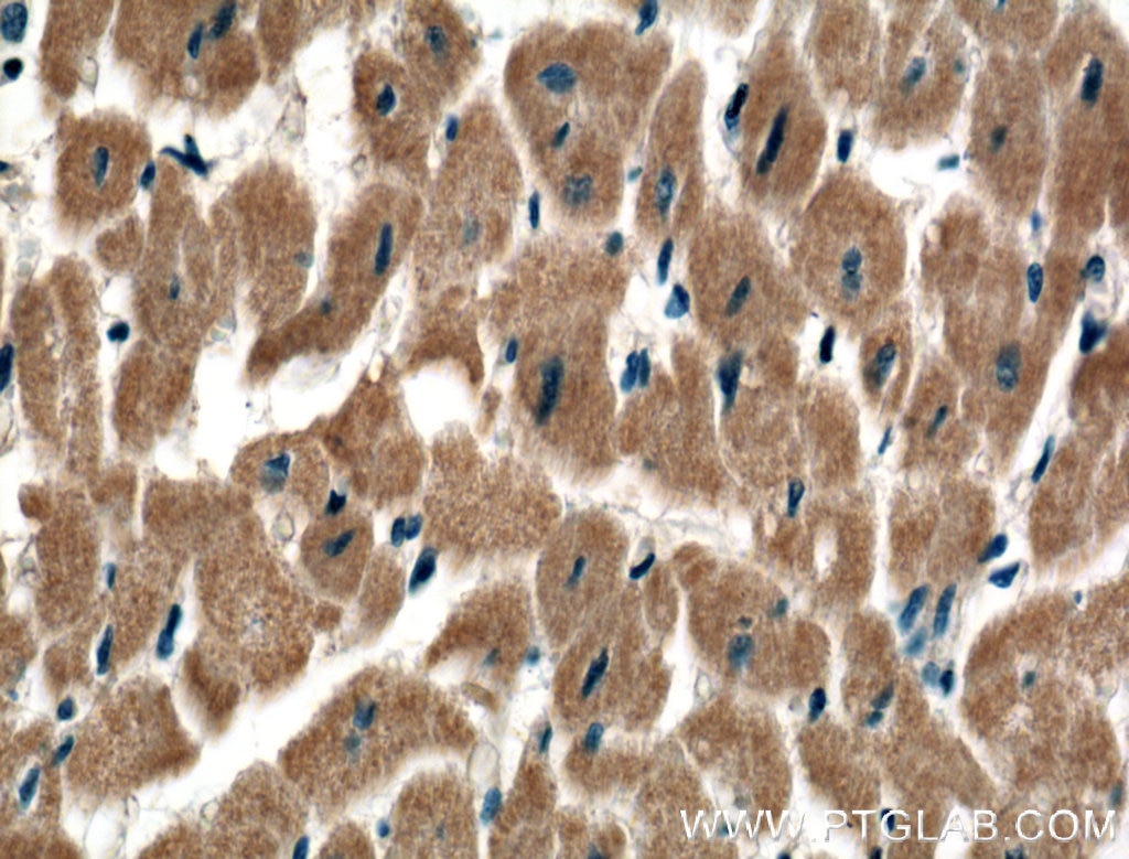 Immunohistochemistry (IHC) staining of human heart tissue using TSPAN31 Polyclonal antibody (21987-1-AP)