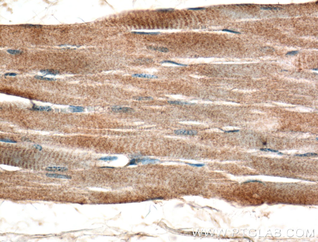 Immunohistochemistry (IHC) staining of human skeletal muscle tissue using TSPAN31 Polyclonal antibody (21987-1-AP)