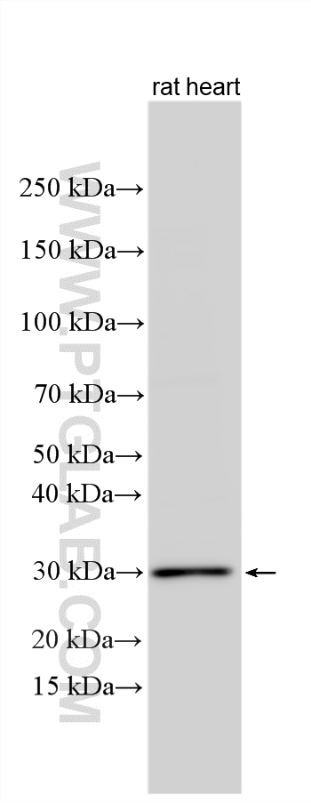 Western Blot (WB) analysis of various lysates using TSPAN31 Polyclonal antibody (21987-1-AP)