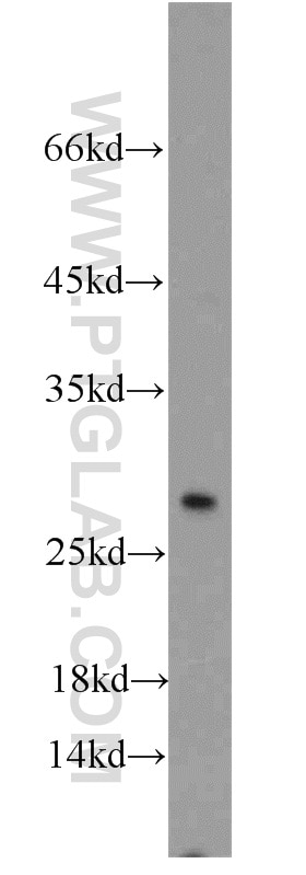 Western Blot (WB) analysis of HepG2 cells using TSPAN31 Polyclonal antibody (21987-1-AP)