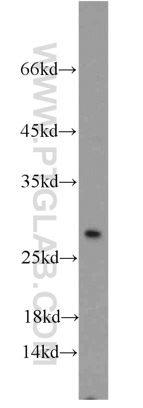 WB analysis of HepG2 using 21987-1-AP