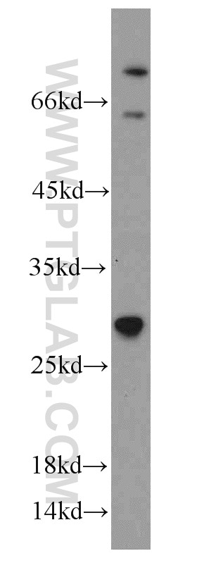 Western Blot (WB) analysis of PC-3 cells using TSPAN31 Polyclonal antibody (21987-1-AP)