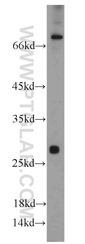Western Blot (WB) analysis of mouse skeletal muscle tissue using TSPAN31 Polyclonal antibody (21987-1-AP)