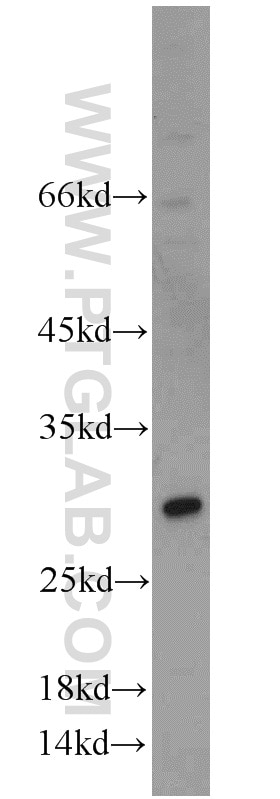 Western Blot (WB) analysis of HeLa cells using TSPAN31 Polyclonal antibody (21987-1-AP)