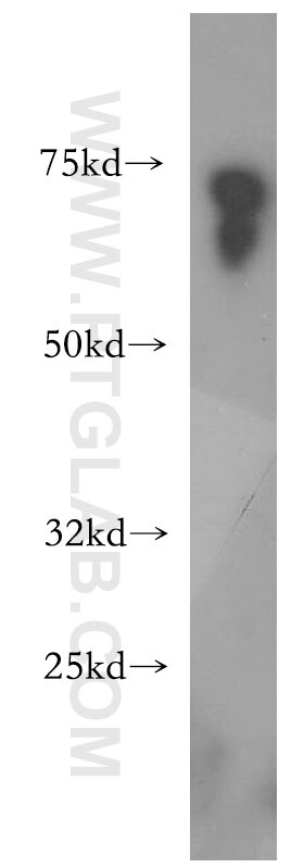 Western Blot (WB) analysis of human plasma using TSPAN33 Polyclonal antibody (14329-1-AP)