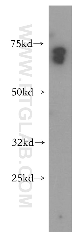 Western Blot (WB) analysis of human brain tissue using TSPAN33 Polyclonal antibody (14329-1-AP)