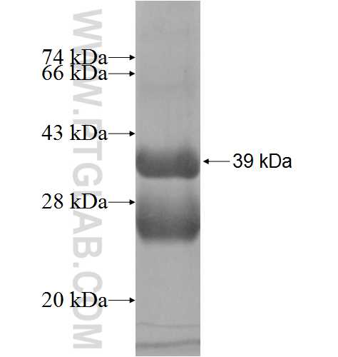 TSPAN33 fusion protein Ag5597 SDS-PAGE