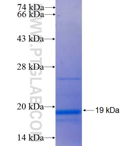 TSPAN33 fusion protein Ag5935 SDS-PAGE