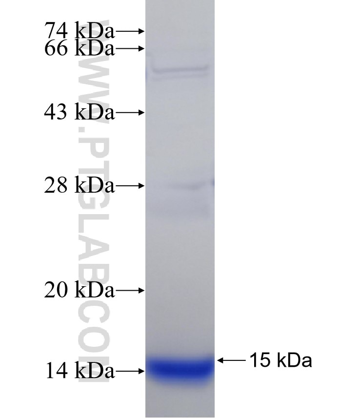 TSPAN4 fusion protein Ag31525 SDS-PAGE