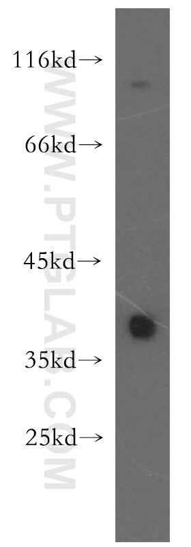 TSPAN5