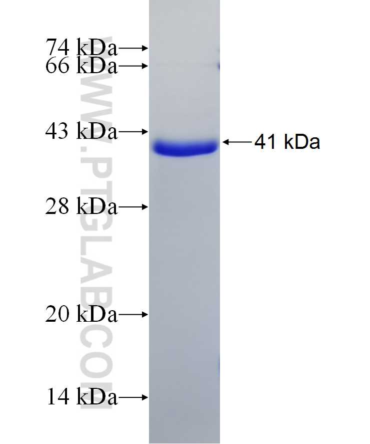 TSPAN5 fusion protein Ag2765 SDS-PAGE