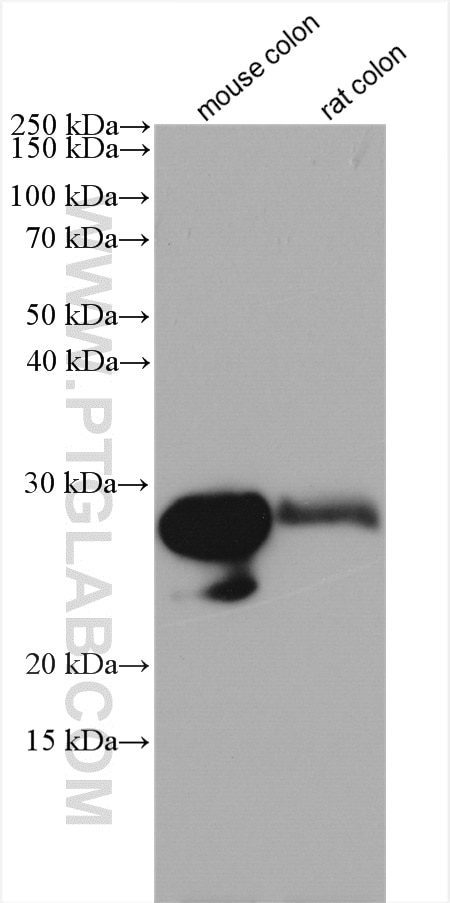 Western Blot (WB) analysis of various lysates using TSPAN6 Polyclonal antibody (12293-1-AP)