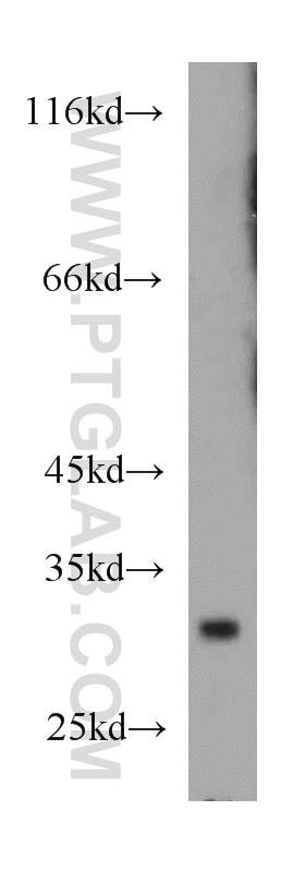 Western Blot (WB) analysis of mouse colon tissue using TSPAN6 Polyclonal antibody (12293-1-AP)