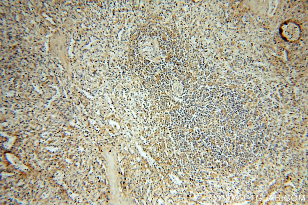 Immunohistochemistry (IHC) staining of human spleen tissue using TSPAN7 Polyclonal antibody (18695-1-AP)