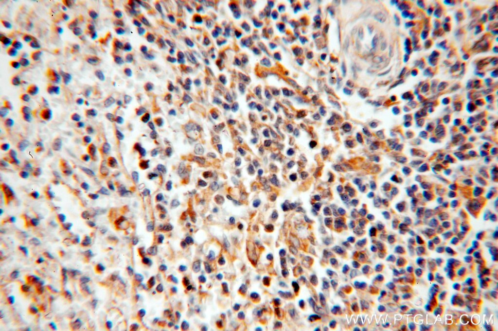 Immunohistochemistry (IHC) staining of human spleen tissue using TSPAN7 Polyclonal antibody (18695-1-AP)