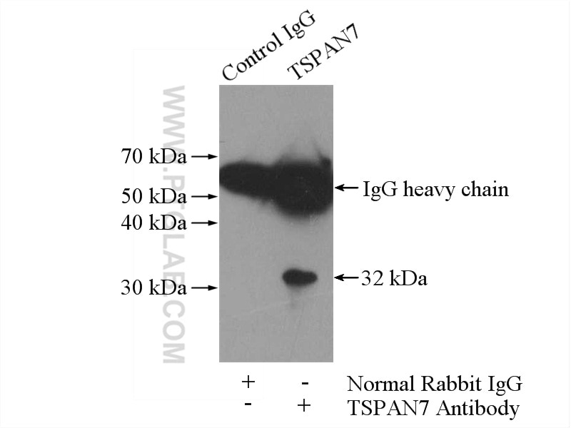 Immunoprecipitation (IP) experiment of K-562 cells using TSPAN7 Polyclonal antibody (18695-1-AP)
