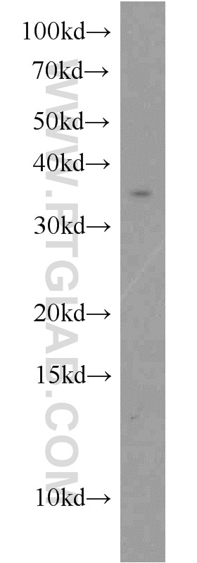 Western Blot (WB) analysis of K-562 cells using TSPAN7 Polyclonal antibody (18695-1-AP)