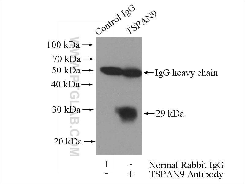 Immunoprecipitation (IP) experiment of mouse spleen tissue using TSPAN9 Polyclonal antibody (21983-1-AP)