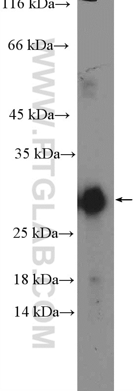 Western Blot (WB) analysis of mouse spleen tissue using TSPAN9 Polyclonal antibody (21983-1-AP)