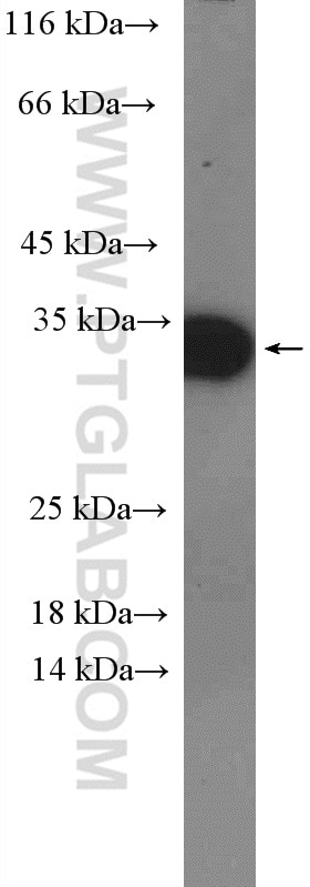 Western Blot (WB) analysis of mouse peripheral blood leukocyte using TSPAN9 Polyclonal antibody (21983-1-AP)