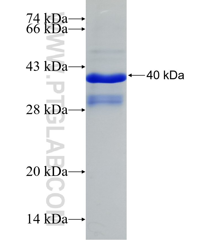 TSPAN9 fusion protein Ag17048 SDS-PAGE