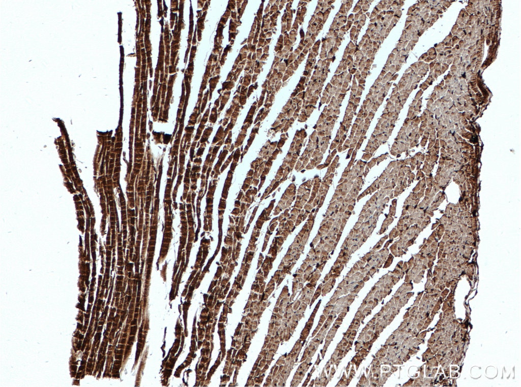 Immunohistochemistry (IHC) staining of mouse heart tissue using TSPO/PBR Polyclonal antibody (15444-1-AP)