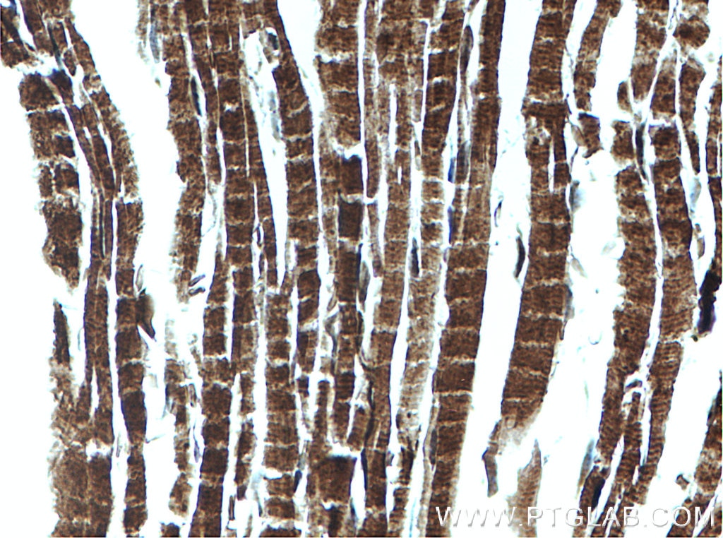 Immunohistochemistry (IHC) staining of mouse heart tissue using TSPO/PBR Polyclonal antibody (15444-1-AP)