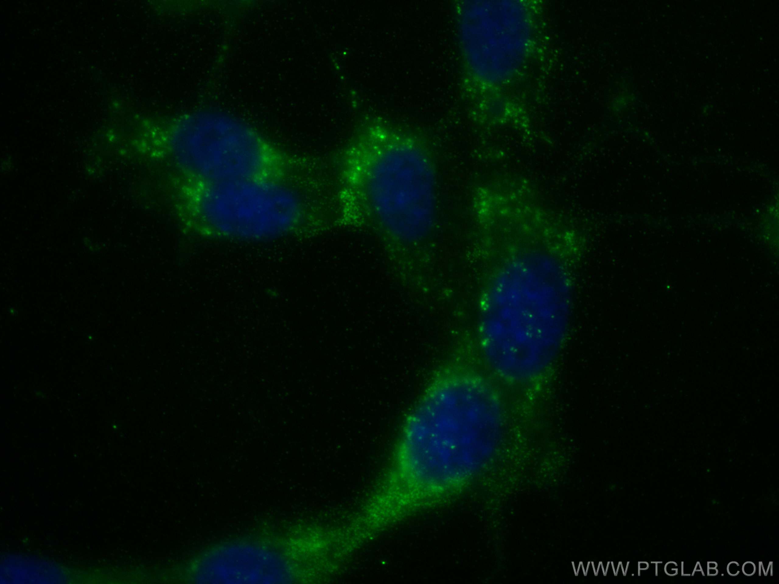 Immunofluorescence (IF) / fluorescent staining of NIH/3T3 cells using TSPO/PBR Monoclonal antibody (68137-1-Ig)