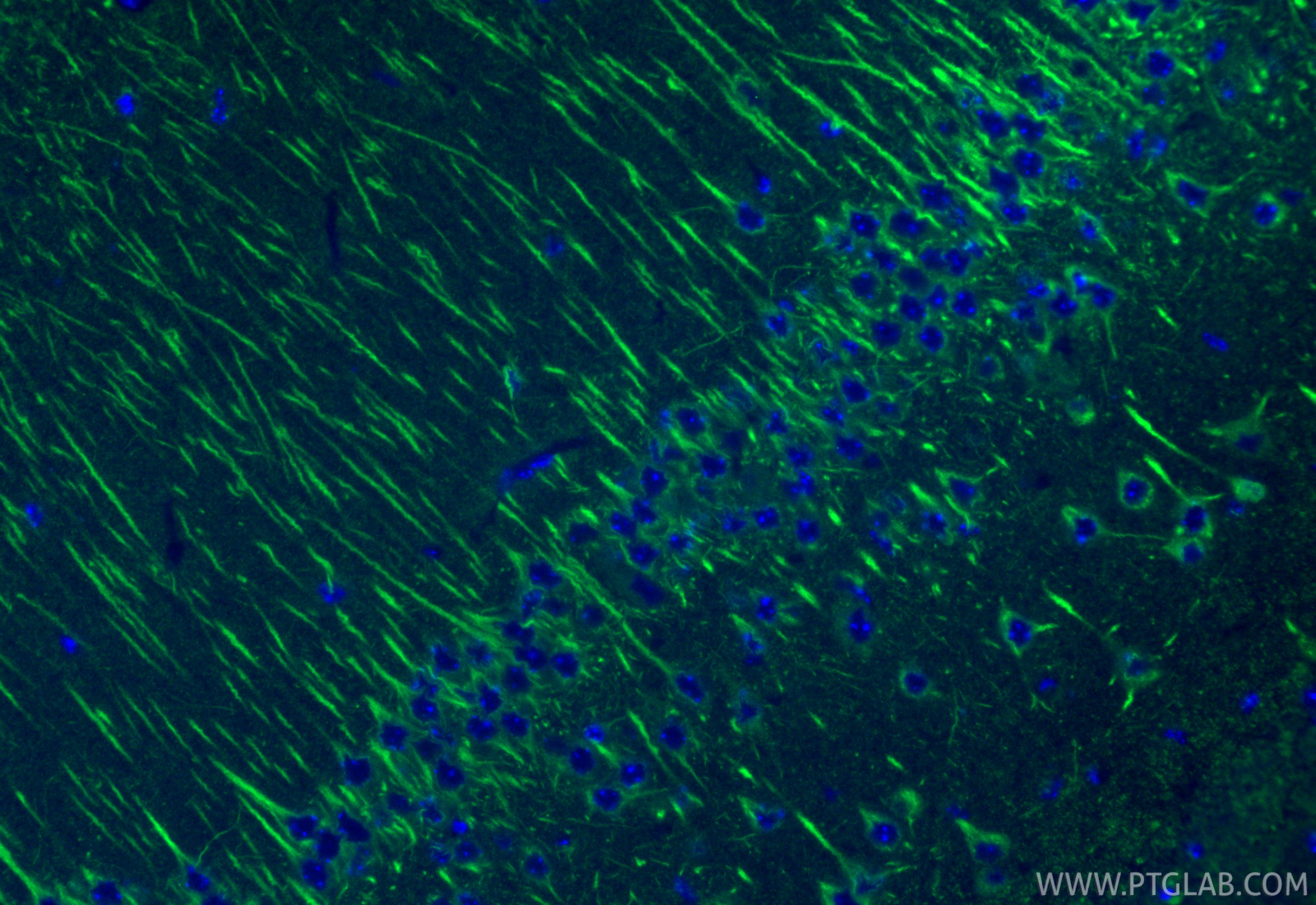 Immunofluorescence (IF) / fluorescent staining of mouse brain tissue using TSPO/PBR Monoclonal antibody (68137-1-Ig)
