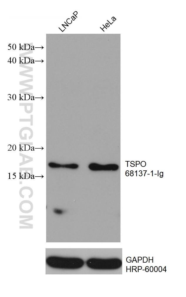 Western Blot (WB) analysis of various lysates using TSPO/PBR Monoclonal antibody (68137-1-Ig)