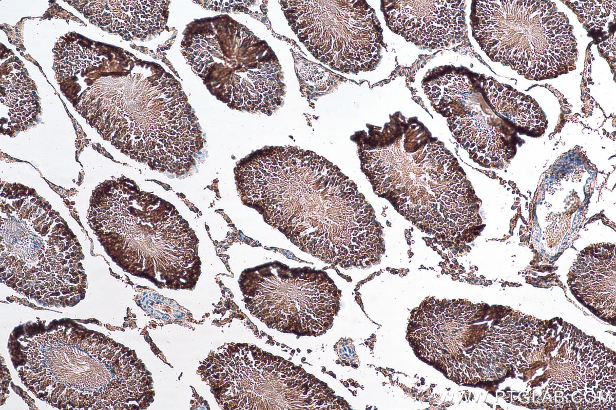 Immunohistochemistry (IHC) staining of rat testis tissue using TSPY3 Polyclonal antibody (22257-1-AP)