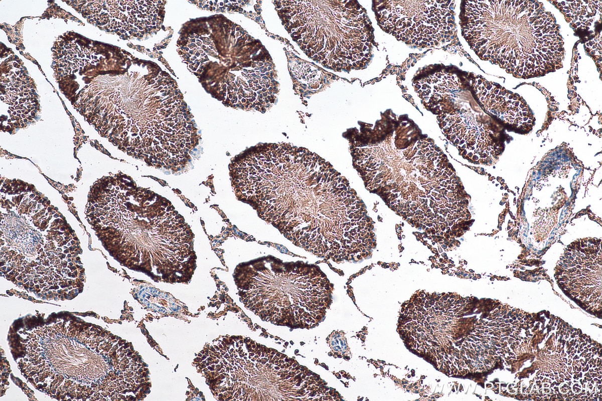 Immunohistochemistry (IHC) staining of rat testis tissue using TSPY3 Polyclonal antibody (22257-1-AP)