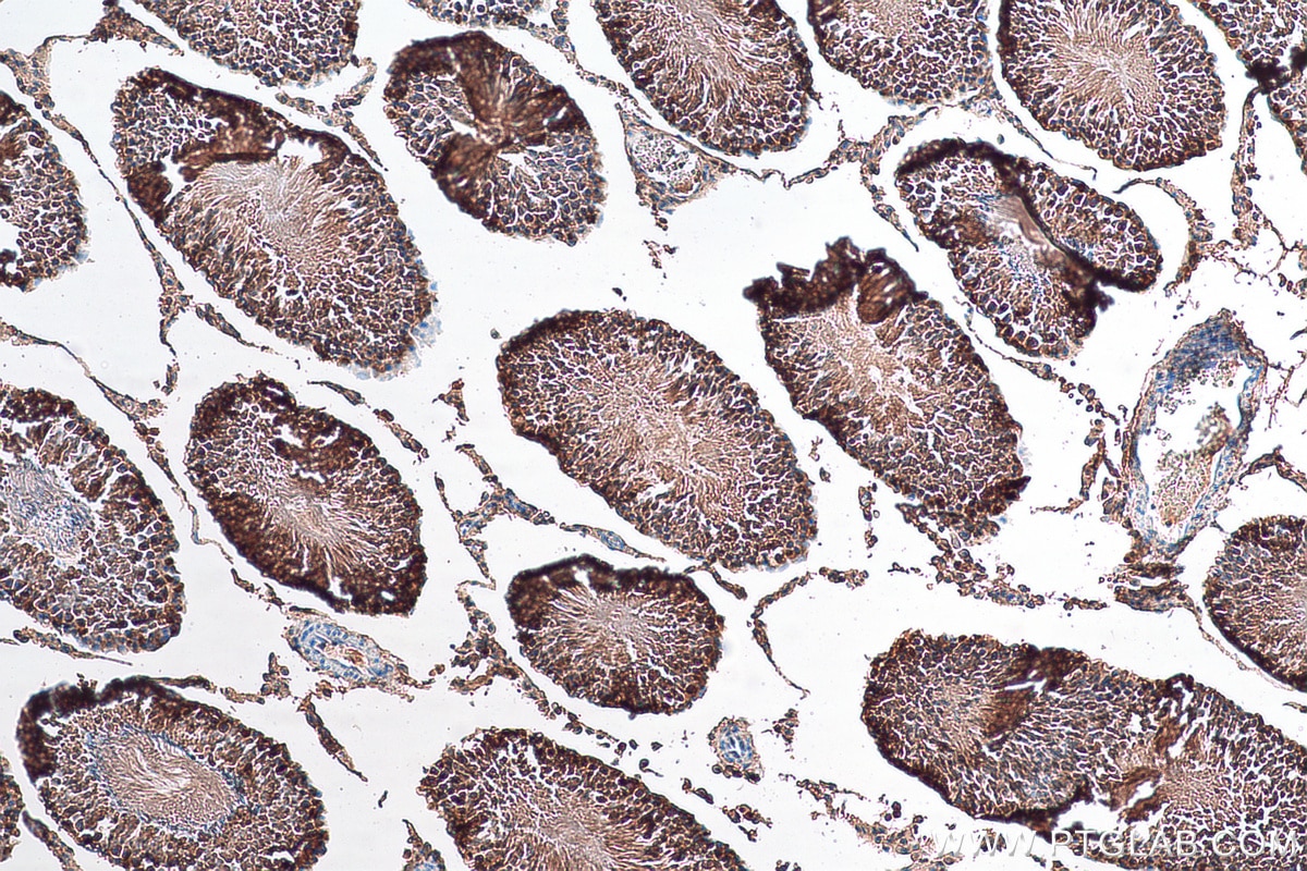 IHC staining of rat testis using 22257-1-AP