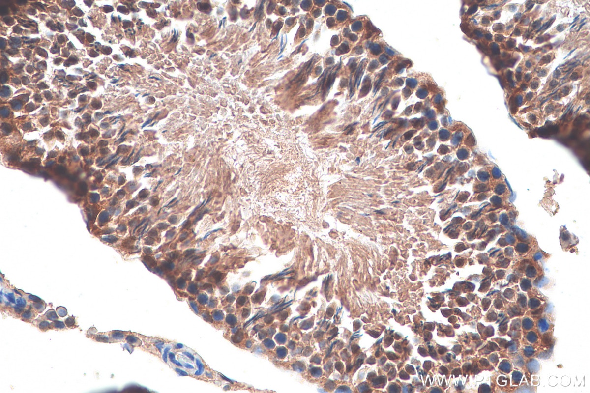 Immunohistochemistry (IHC) staining of rat testis tissue using TSPY3 Polyclonal antibody (22257-1-AP)