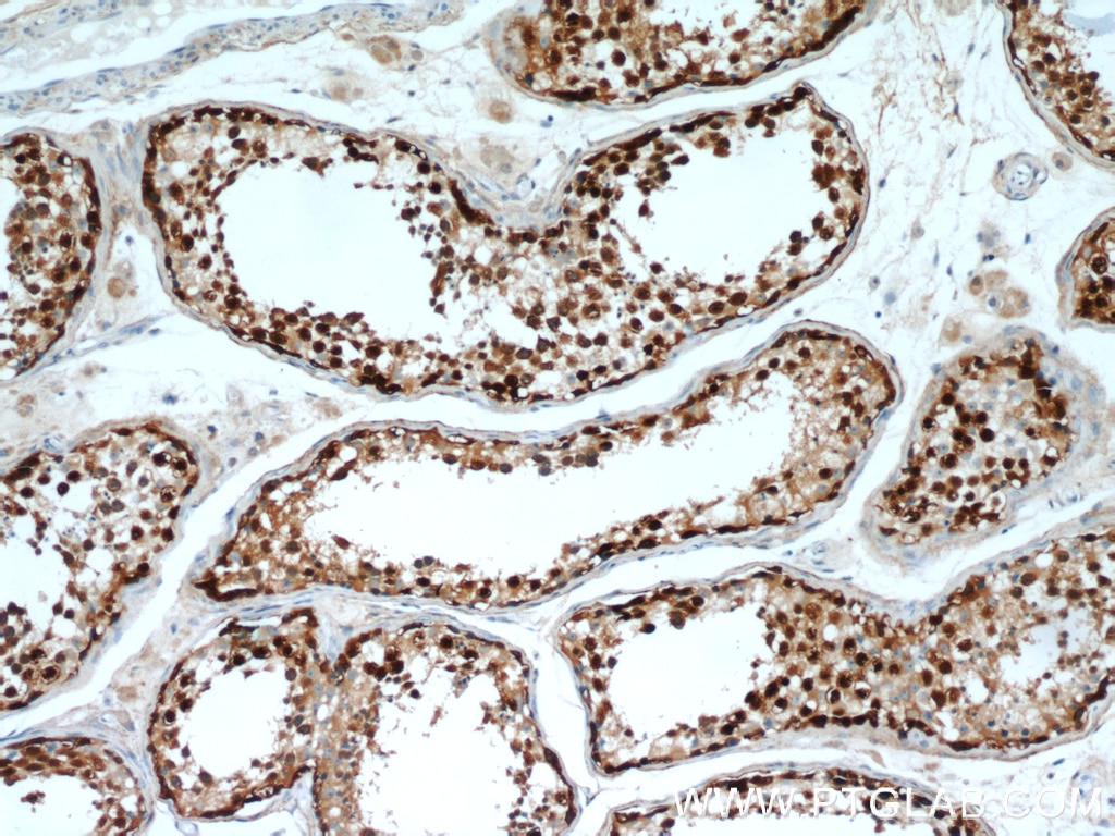 Immunohistochemistry (IHC) staining of human testis tissue using TSPY3 Polyclonal antibody (22257-1-AP)