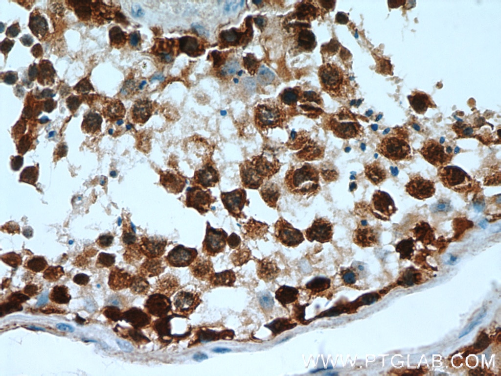 Immunohistochemistry (IHC) staining of human testis tissue using TSPY3 Polyclonal antibody (22257-1-AP)