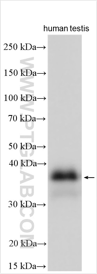 Western Blot (WB) analysis of human testis tissue using TSPY3 Polyclonal antibody (22257-1-AP)