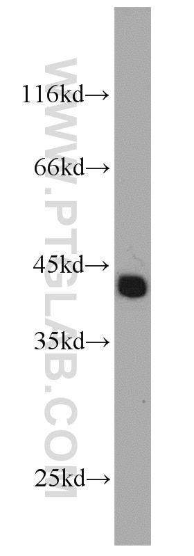 Western Blot (WB) analysis of LNCaP cells using TSPY3 Polyclonal antibody (22257-1-AP)