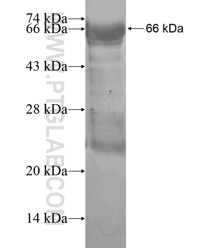 TSPY3 fusion protein Ag17762 SDS-PAGE