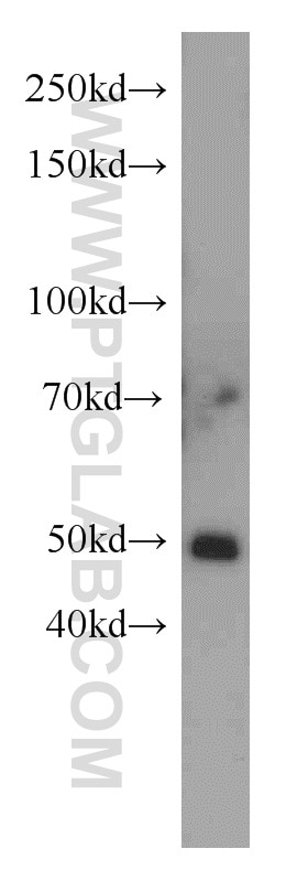 Western Blot (WB) analysis of mouse heart tissue using TSPYL1 Polyclonal antibody (13932-1-AP)