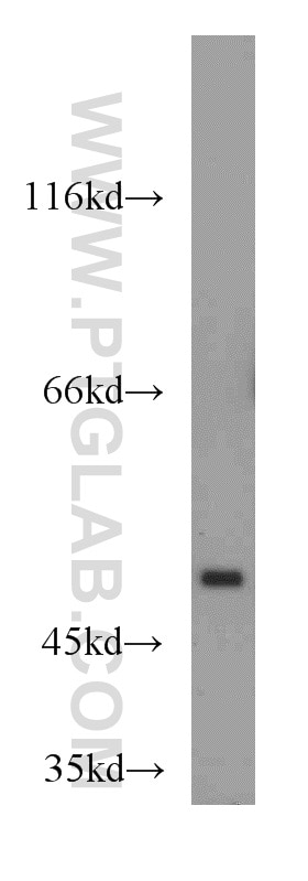 Western Blot (WB) analysis of mouse lung tissue using TSPYL1 Polyclonal antibody (13932-1-AP)