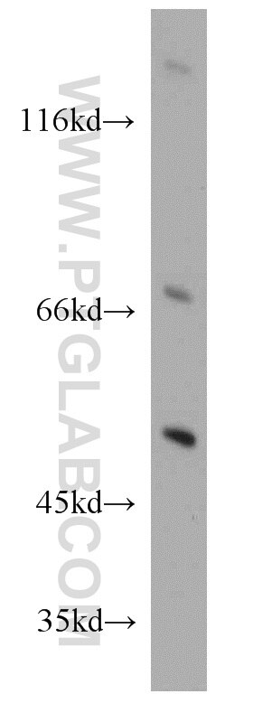 Western Blot (WB) analysis of mouse kidney tissue using TSPYL1 Polyclonal antibody (13932-1-AP)