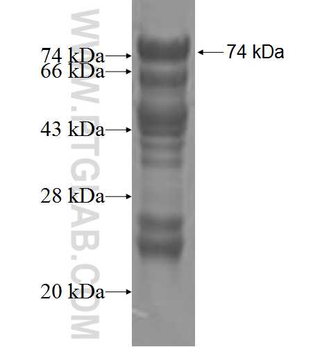 TSPYL1 fusion protein Ag4961 SDS-PAGE