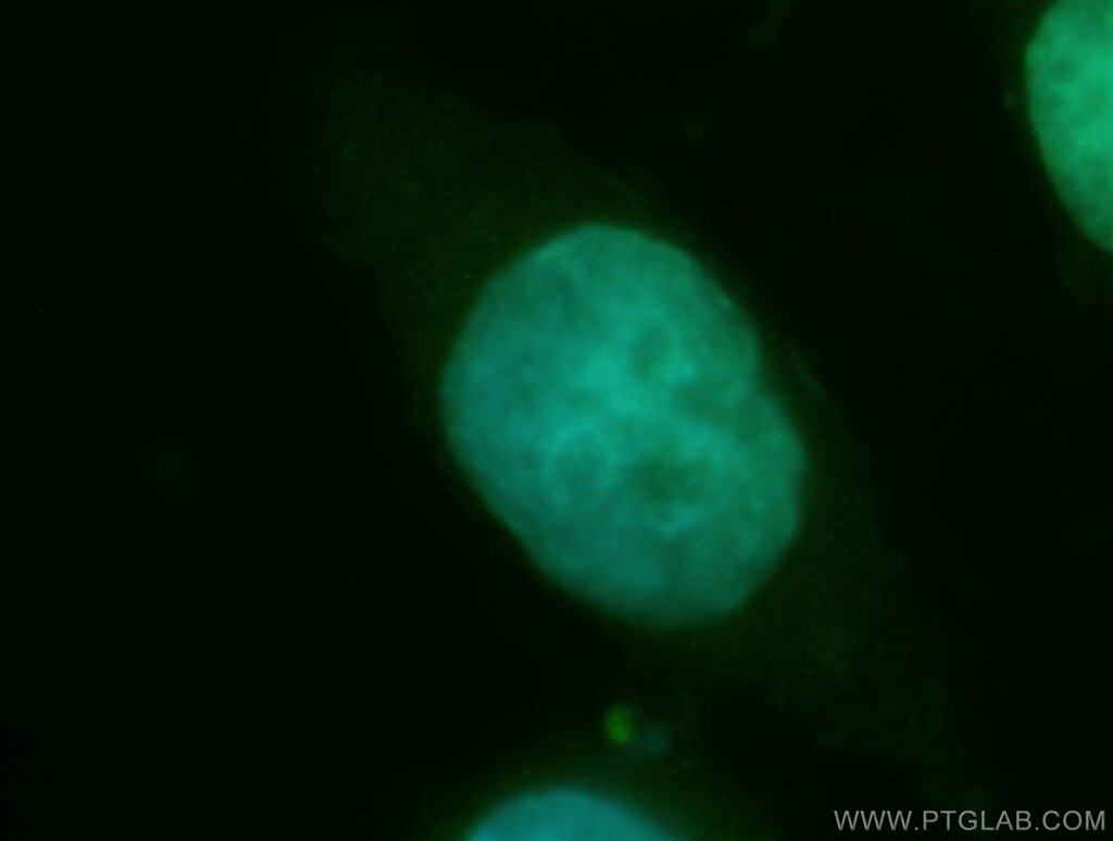Immunofluorescence (IF) / fluorescent staining of HeLa cells using CDA1 Polyclonal antibody (12087-2-AP)