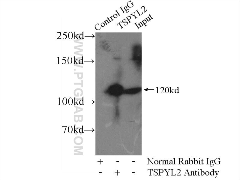 IP experiment of HEK-293 using 12087-2-AP