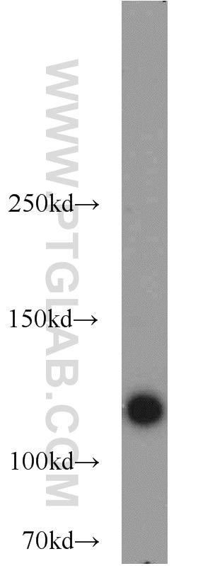 Western Blot (WB) analysis of HeLa cells using CDA1 Polyclonal antibody (12087-2-AP)