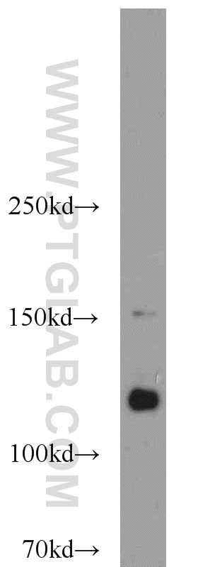 Western Blot (WB) analysis of HEK-293 cells using CDA1 Polyclonal antibody (12087-2-AP)