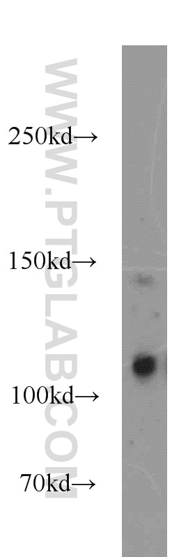 Western Blot (WB) analysis of MCF-7 cells using CDA1 Polyclonal antibody (12087-2-AP)